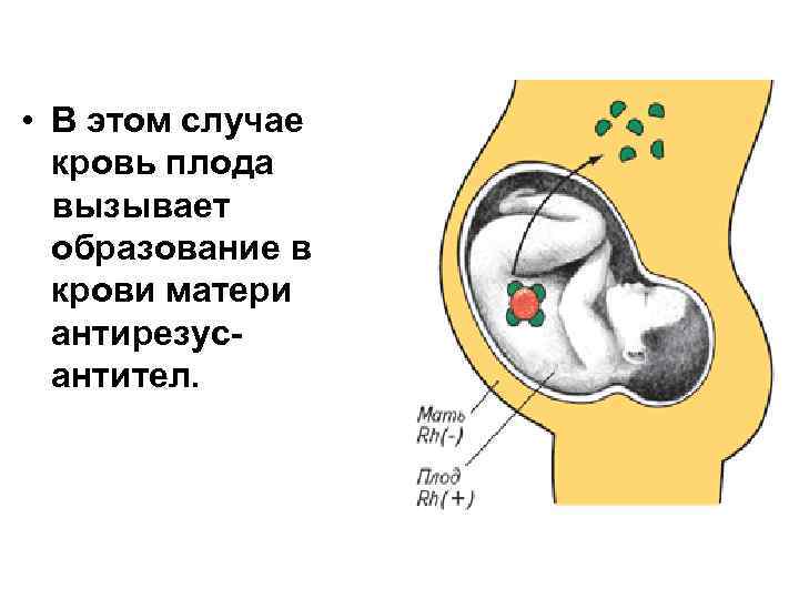 • В этом случае кровь плода вызывает образование в крови матери антирезусантител. 