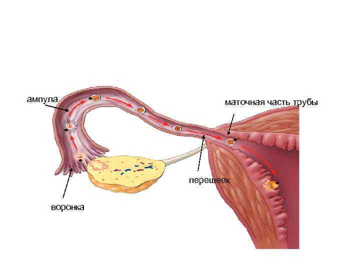 ампула маточная часть трубы перешеек воронка 