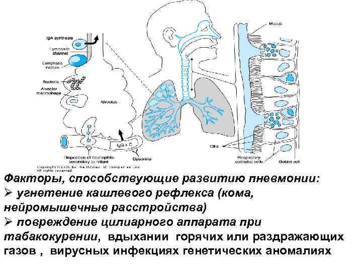 Схема кашлевого рефлекса