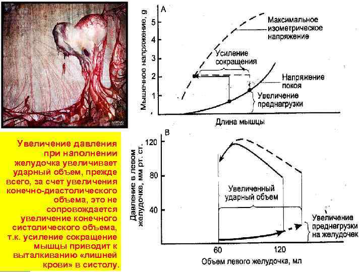 Увеличение давления при наполнении желудочка увеличивает ударный объем, прежде всего, за счет увеличения конечно-диастолического