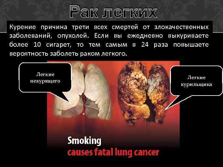 Рак легких Курение причина трети всех смертей от злокачественных заболеваний, опухолей. Если вы ежедневно