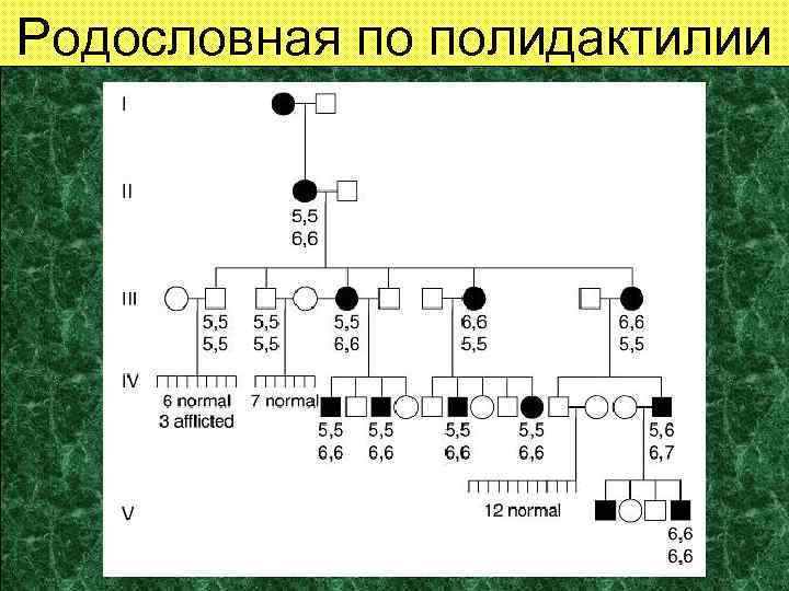Родословная по полидактилии 