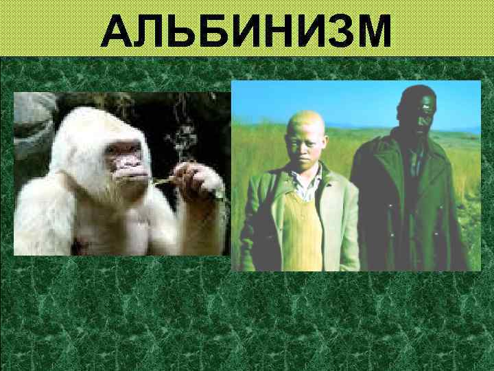 АЛЬБИНИЗМ 