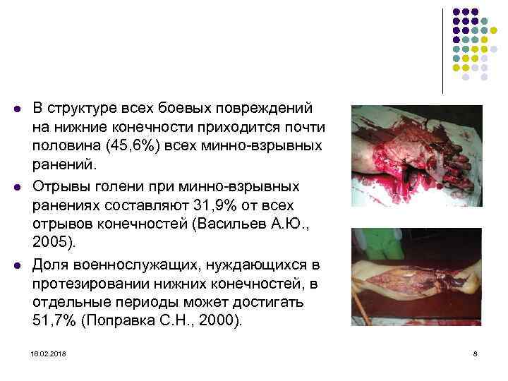 l l l В структуре всех боевых повреждений на нижние конечности приходится почти половина