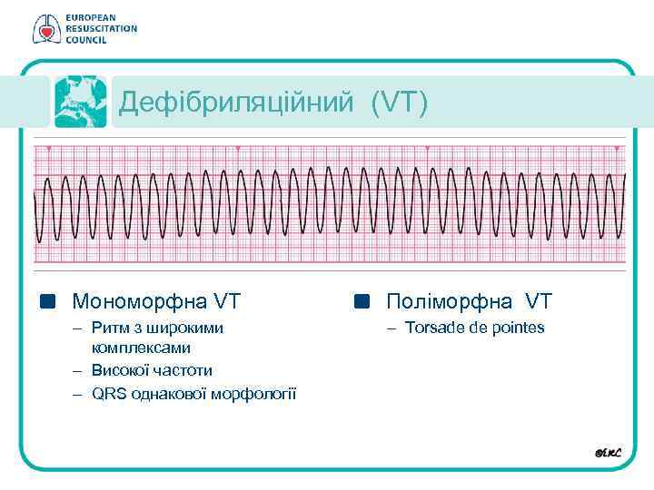 Дефібриляційний (VT) Moноморфна VT Поліморфна VT – Ритм з широкими комплексами – Високої частоти