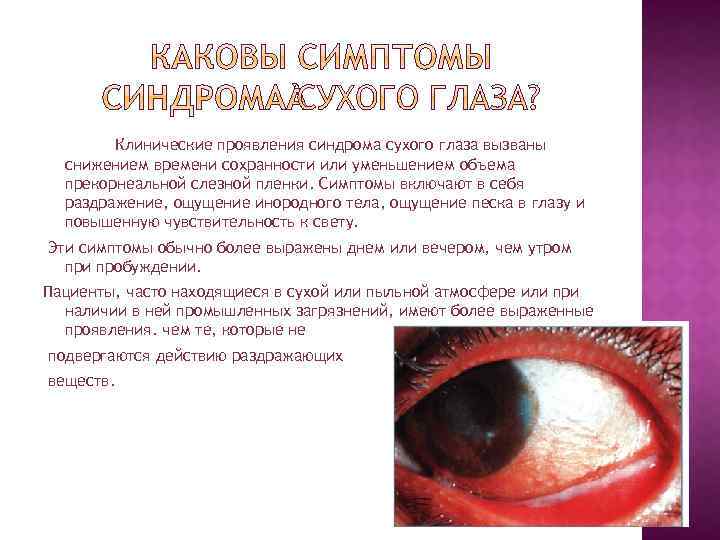 Клинические проявления синдрома сухого глаза вызваны снижением времени сохранности или уменьшением объема прекорнеальной слезной