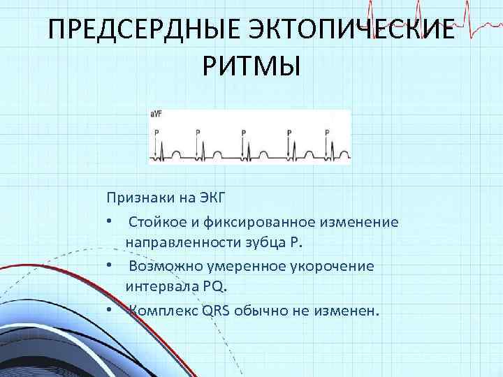 Эктопический ритм