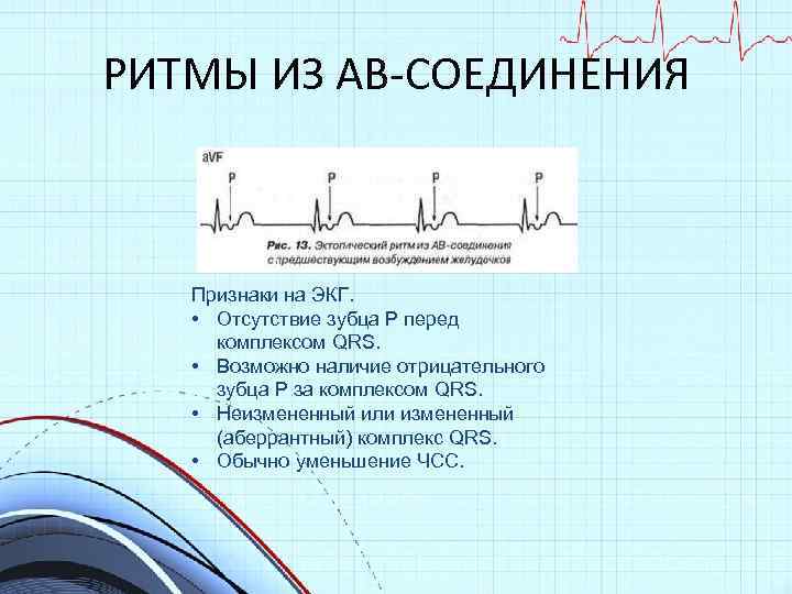 РИТМЫ ИЗ АВ-СОЕДИНЕНИЯ Признаки на ЭКГ. • Отсутствие зубца Р перед комплексом QRS. •