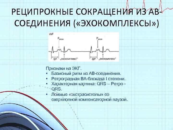 РЕЦИПРОКНЫЕ СОКРАЩЕНИЯ ИЗ АВСОЕДИНЕНИЯ ( «ЭХОКОМПЛЕКСЫ» ) Признаки на ЭКГ. • Базисный ритм из