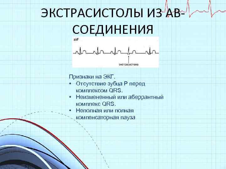 ЭКСТРАСИСТОЛЫ ИЗ АВСОЕДИНЕНИЯ Признаки на ЭКГ. • Отсутствие зубца Р перед комплексом QRS. •