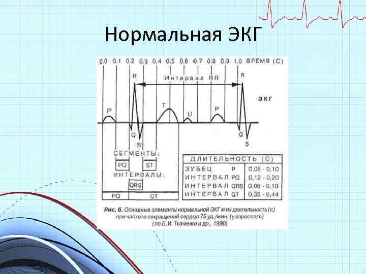 Компьютерное заключение синусовый ритм что это