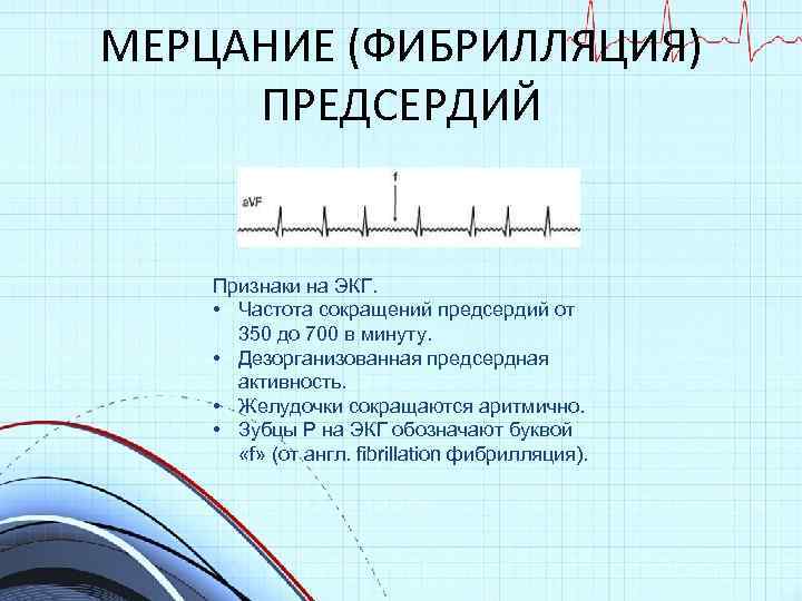 МЕРЦАНИЕ (ФИБРИЛЛЯЦИЯ) ПРЕДСЕРДИЙ Признаки на ЭКГ. • Частота сокращений предсердий от 350 до 700