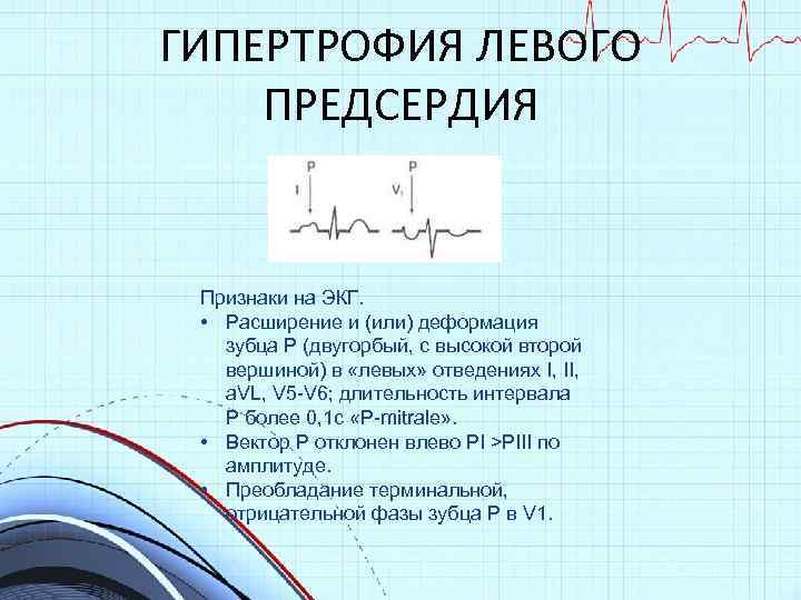 ГИПЕРТРОФИЯ ЛЕВОГО ПРЕДСЕРДИЯ Признаки на ЭКГ. • Расширение и (или) деформация зубца Р (двугорбый,