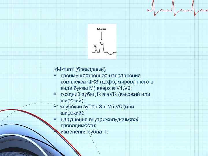  «М-тип» (блокадный) • преимущественное направление комплекса QRS (деформированного в виде буквы М) вверх