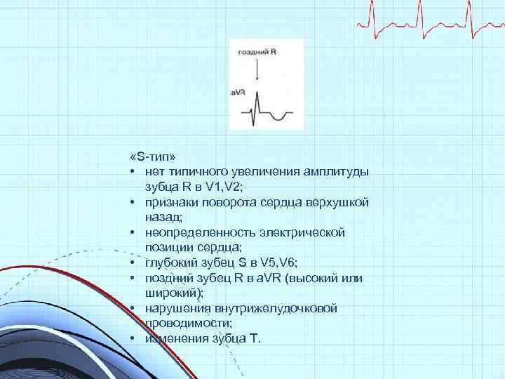 Высокий т на экг причины. ЭКГ зубец s в v5-v6. Глубокий зубец s в v2. Зубцы s в v5 v6.