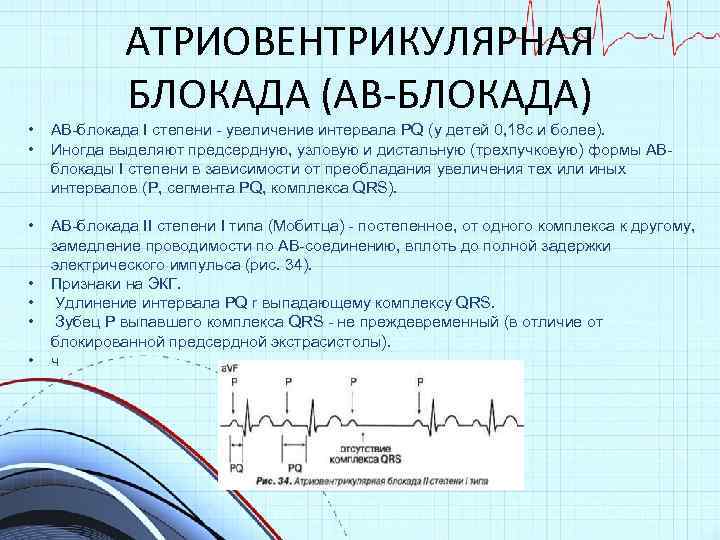 Увеличение интервала. Интервал PQ на ЭКГ. Увеличение интервала PQ на ЭКГ. Удлинение интервала PQ на ЭКГ. Увеличение продолжительности интервала PQ.