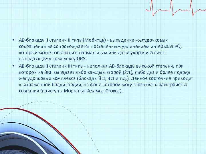  • АВ-блокада II степени II типа (Мобитца) - выпадение желудочковых сокращений не сопровождается