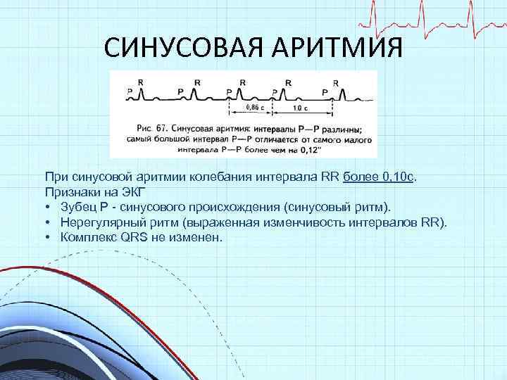 Нерегулярность ритма сердца процентах