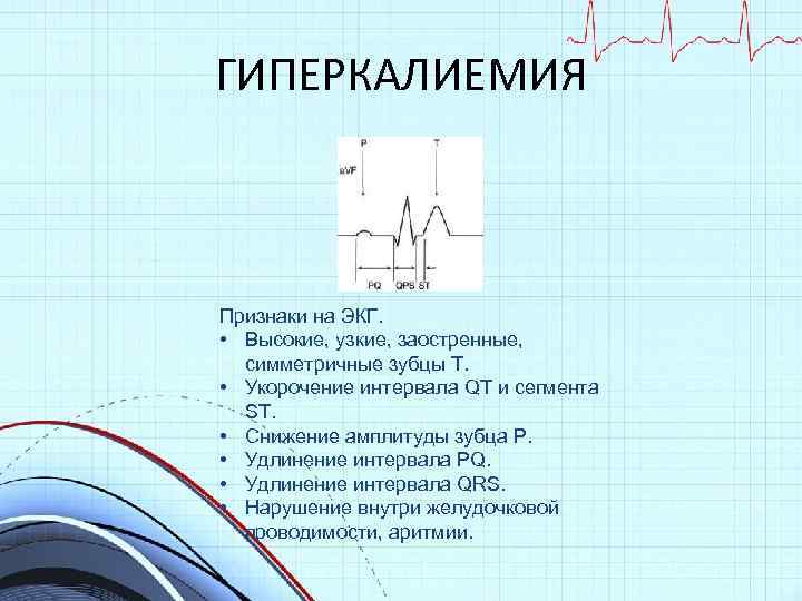 Экг при гиперкалиемии картинки