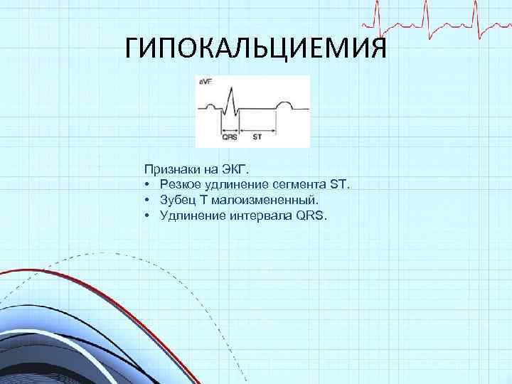 ГИПОКАЛЬЦИЕМИЯ Признаки на ЭКГ. • Резкое удлинение сегмента ST. • Зубец Т малоизмененный. •