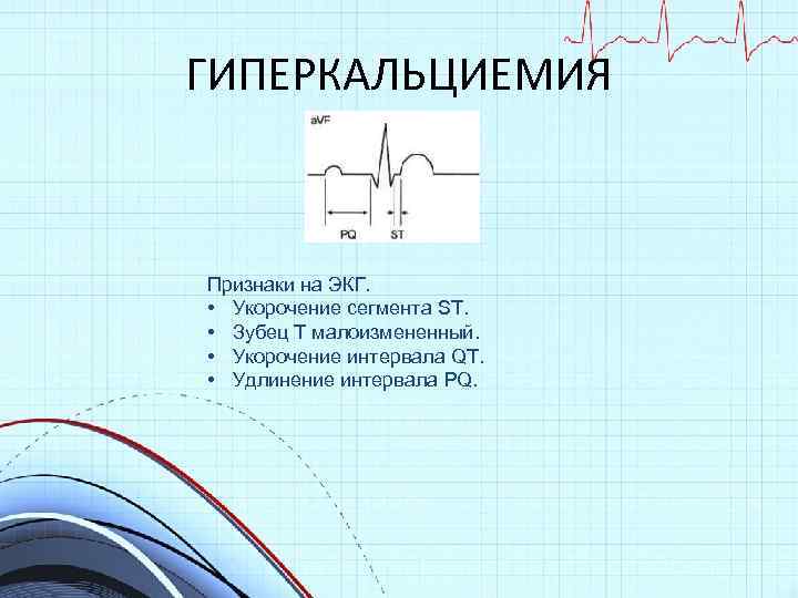 Экг укорочение интервала