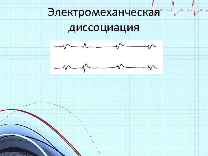 Электромеханческая диссоциация 