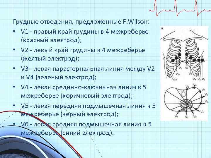 Грудные отведения, предложенные F. Wilson: • V 1 - правый край грудины в 4