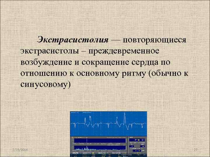 Экстрасистолия — повторяющиеся экстрасистолы – преждевременное возбуждение и сокращение сердца по отношению к основному