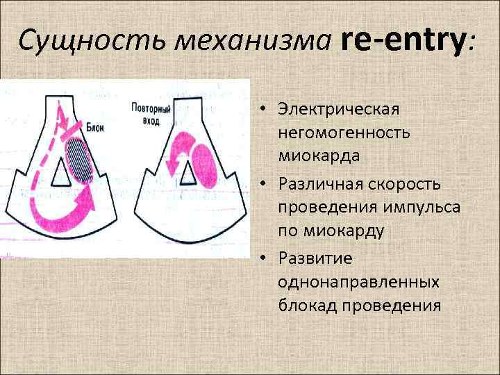 Механизм сущность. Механизм риентри аритмий. Возникновение аритмии по механизму макро-Ре-энтри. Механизм Ри энтри это. Механизм микро Ри энтри.