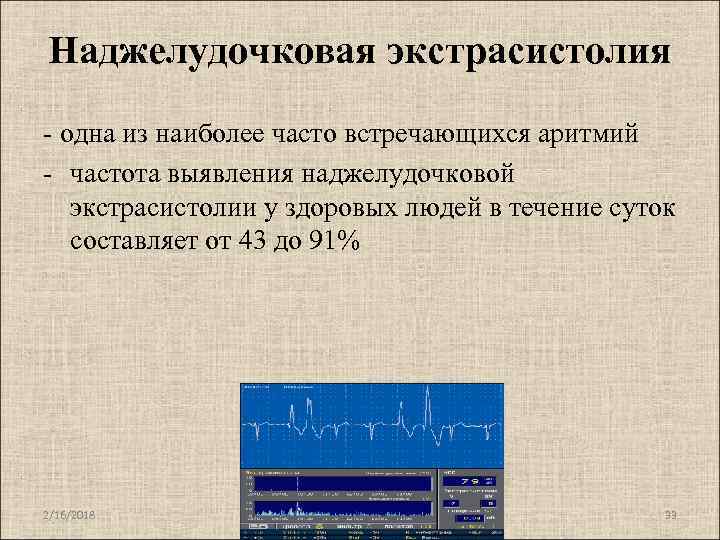 Нарушение ритма наджелудочковой экстрасистолии