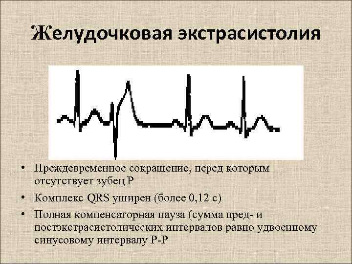 Ритм сокращения