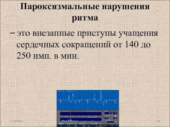 Пароксизмальные нарушения ритма – это внезапные приступы учащения сердечных сокращений от 140 до 250