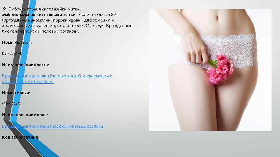 v Эмбриональная киста шейки матки - болезнь класса XVII (Врожденные аномалии [пороки крови], деформации