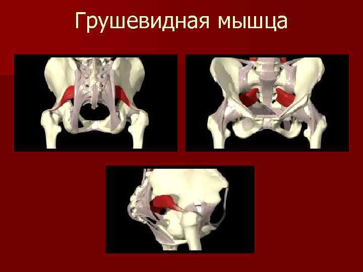 Грушевидная мышца картинки