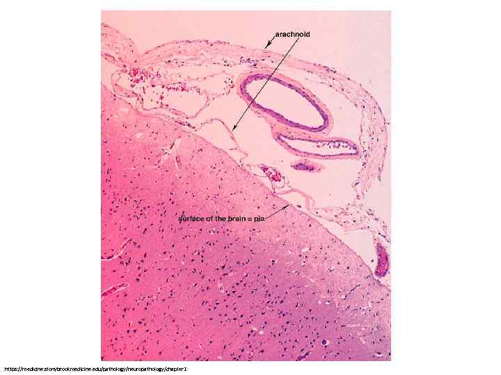 https: //medicine. stonybrookmedicine. edu/pathology/neuropathology/chapter 1 