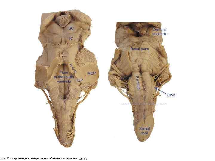 http: //clinicalgate. com/wp-content/uploads/2015/03/B 9780323045704000111_gr 1. jpg 