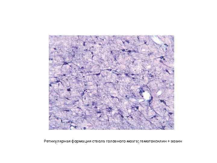 Ретикулярная формация ствола головного мозга; гематоксилин + эозин 