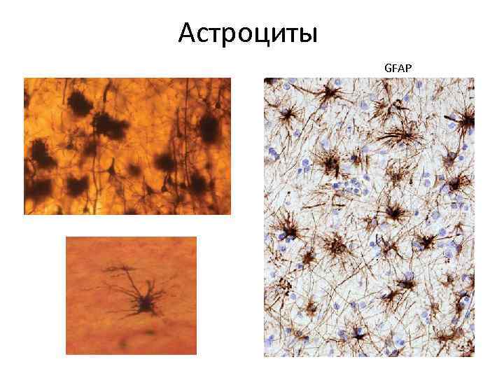 Астроциты GFAP 