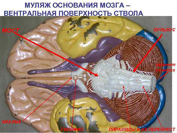 МУЛЯЖ ОСНОВАНИЯ МОЗГА – ВЕНТРАЛЬНАЯ ПОВЕРХНОСТЬ СТВОЛА БУЛЬБУС МОСТ сегмент сп. мозга ХИАЗМА ГИПОФИЗ