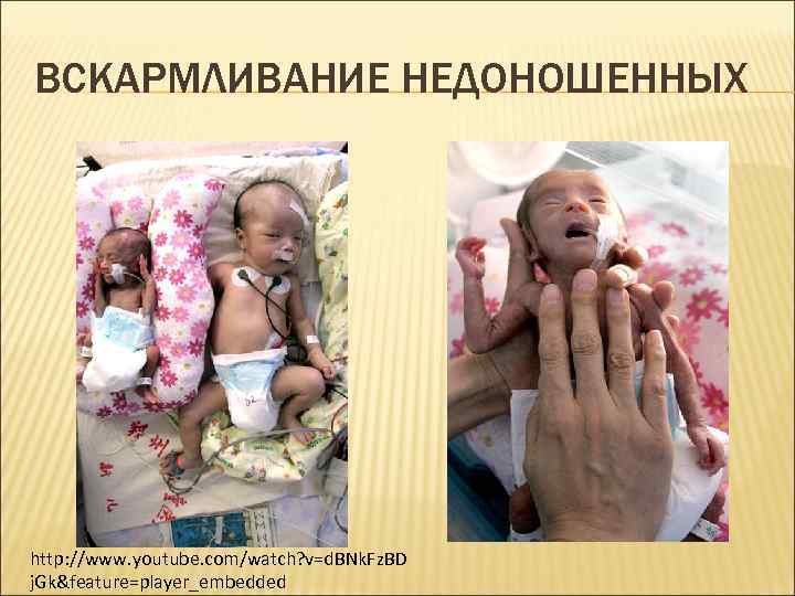 ВСКАРМЛИВАНИЕ НЕДОНОШЕННЫХ http: //www. youtube. com/watch? v=d. BNk. Fz. BD j. Gk&feature=player_embedded 