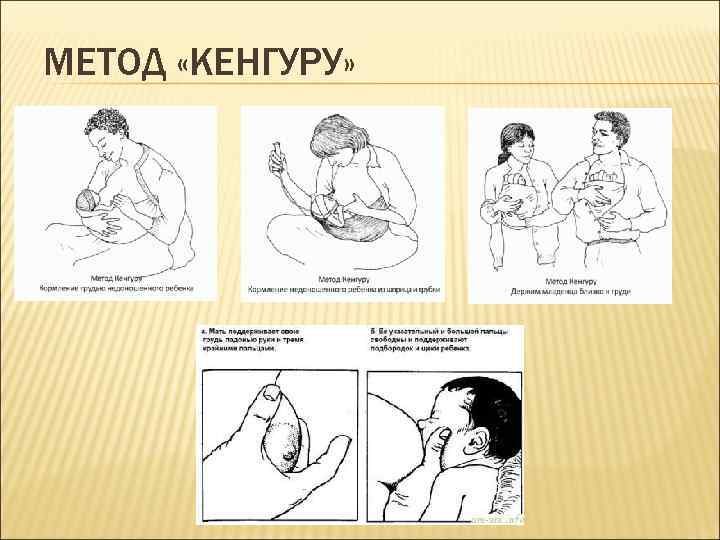 МЕТОД «КЕНГУРУ» 