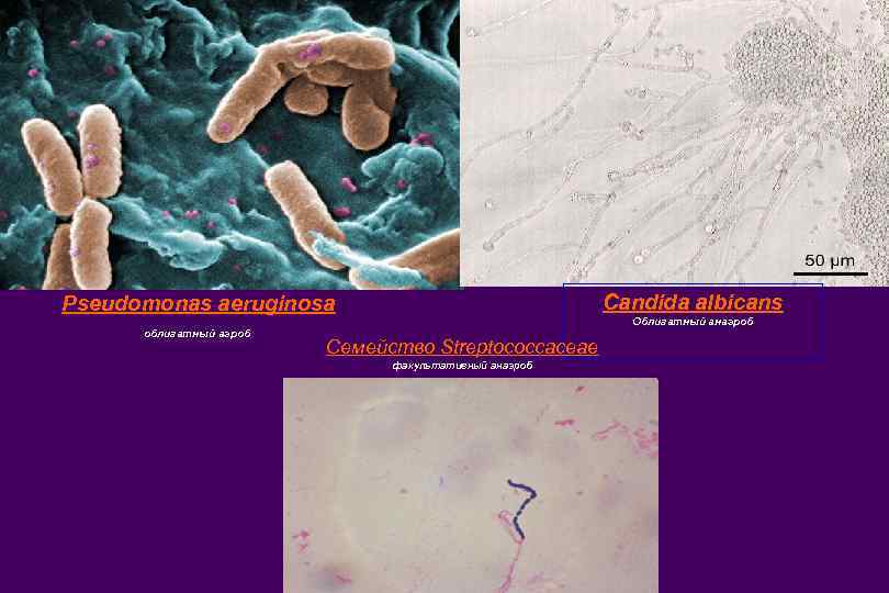Микробиологические на аэробные микроорганизмы. Облигатные анаэробы это микробиология. Облигатные анаэробные микроорганизмы. Облигатные анаэробные бактерии. Аэробные бактерии.