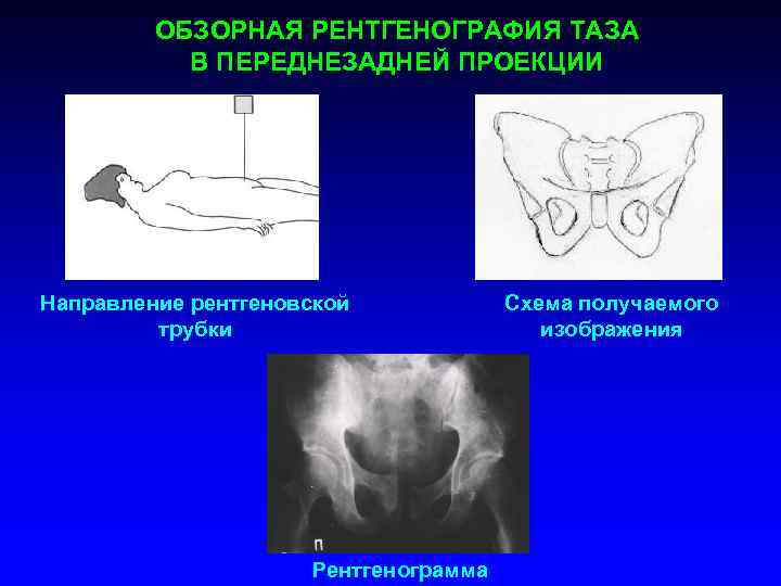 При рентгеноскопии изображение получается