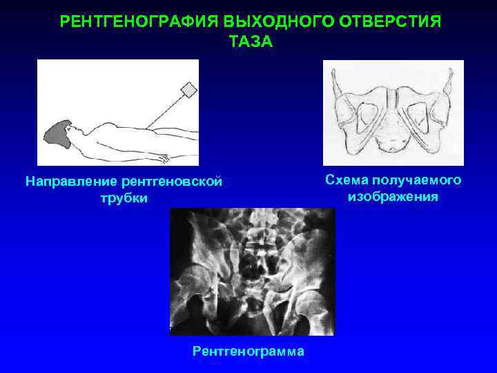 Рентгенография с прямым увеличением изображения применяется тест