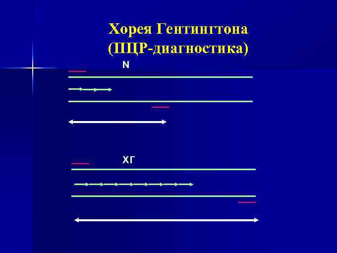 Хорея Гентингтона (ПЦР-диагностика) N ХГ 