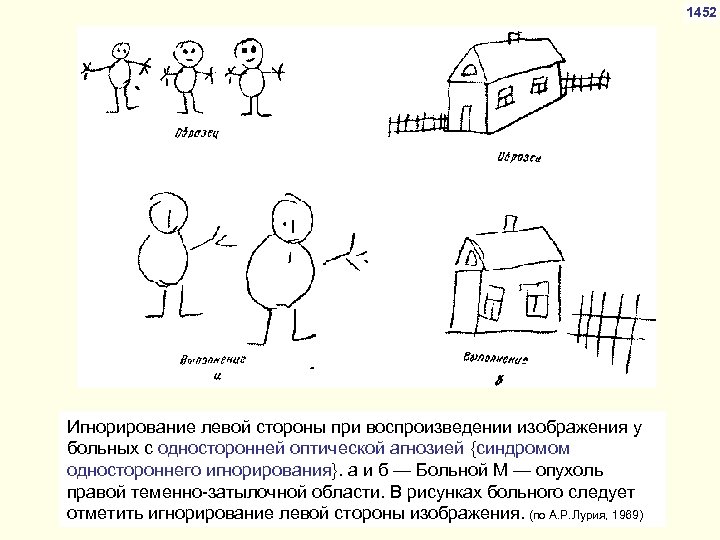 Вид агнозии характеризующийся нарушением узнавания предметов или их изображений