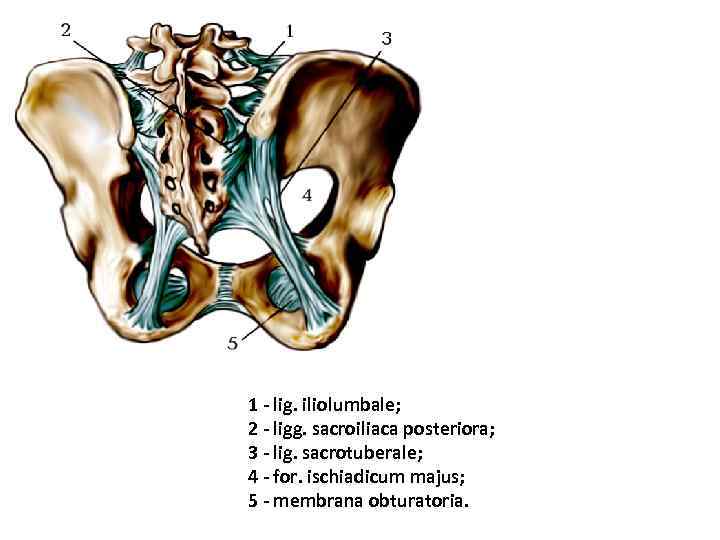 1 - lig. iliolumbale; 2 - ligg. sacroiliaca posteriora; 3 - lig. sacrotuberale; 4
