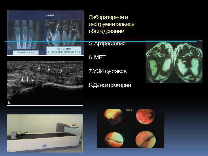 Лабораторное и инструментальное обследование 5. Артроскопия 6. МРТ 7. УЗИ суставов 8. Денситометрия 