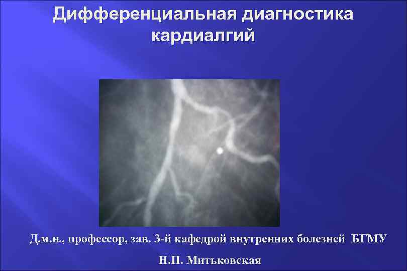 Дифференциальная диагностика кардиалгий Д. м. н. , профессор, зав. 3 -й кафедрой внутренних болезней