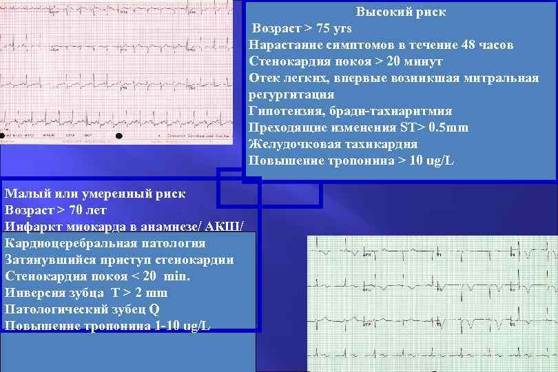 Высокий риск Возраст > 75 yrs Нарастание симптомов в течение 48 часов Стенокардия покоя